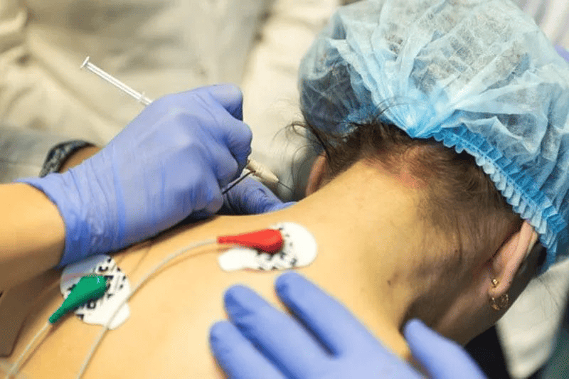 Ботулинотерапия