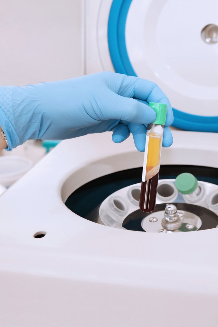 Плазмотерапия (PRP-терапия)